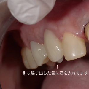 SHOFU DENTAL DIGITAL CAMERA